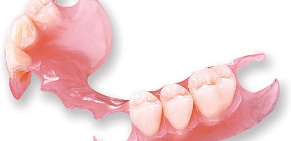 Removable Partial Dentures